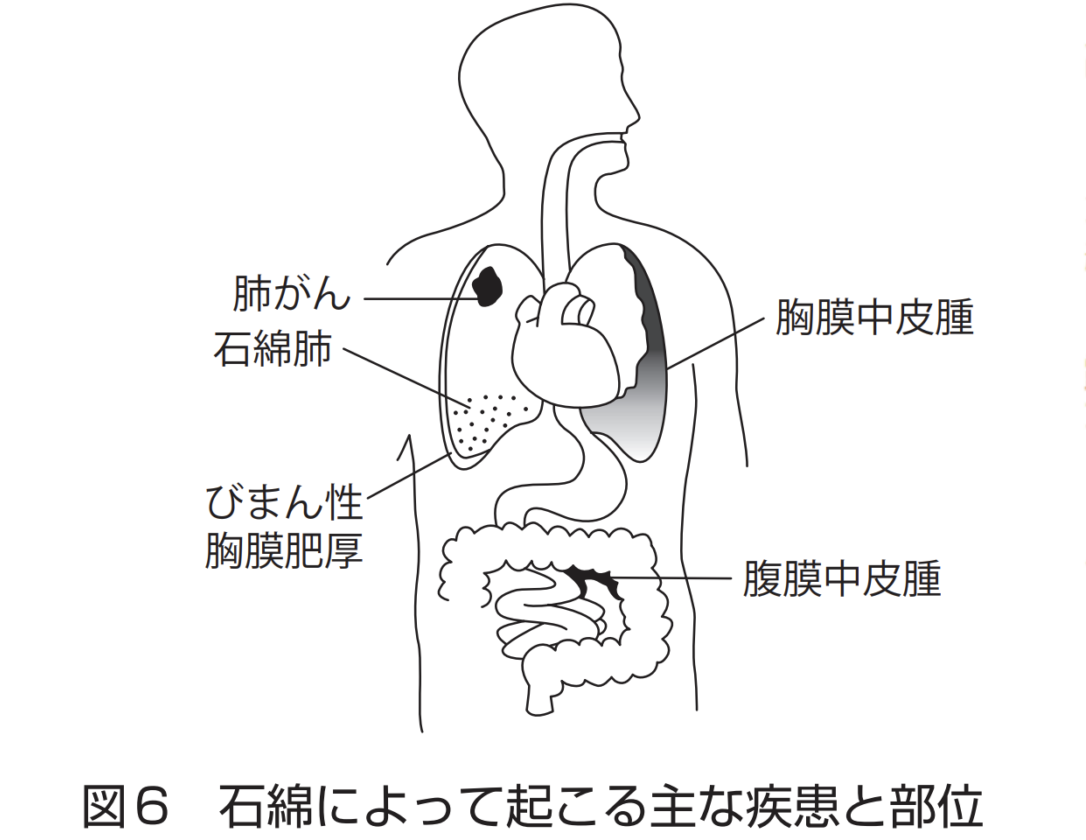 大阪府堺市・アスベスト調査の義務を怠ると工事中断？工場・倉庫の改修は一括対応業者へ！_健康被害